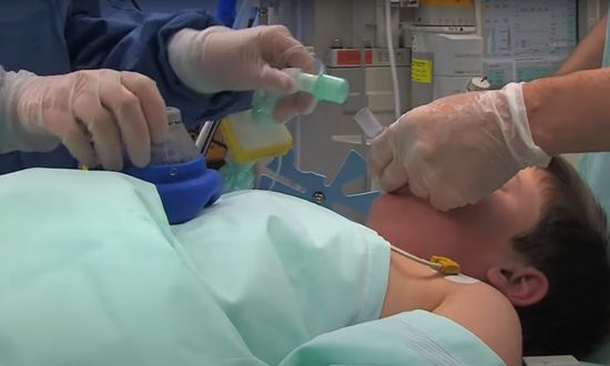 Paediatric Anaesthesia using i-gel®